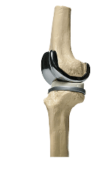best orthopedic surgeon in dubai